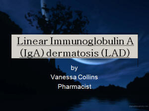 Linear Immunoglobulin A (IgA) dermatosis (LAD)